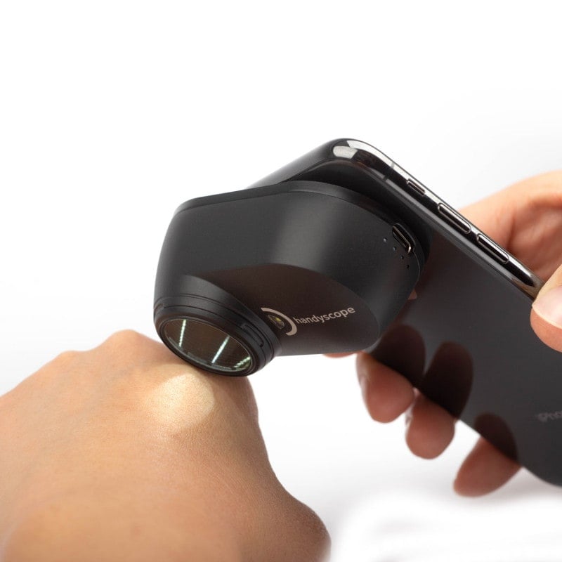 Dermatoscopio DERMLITE HANDYSCOPE - Imagen 2