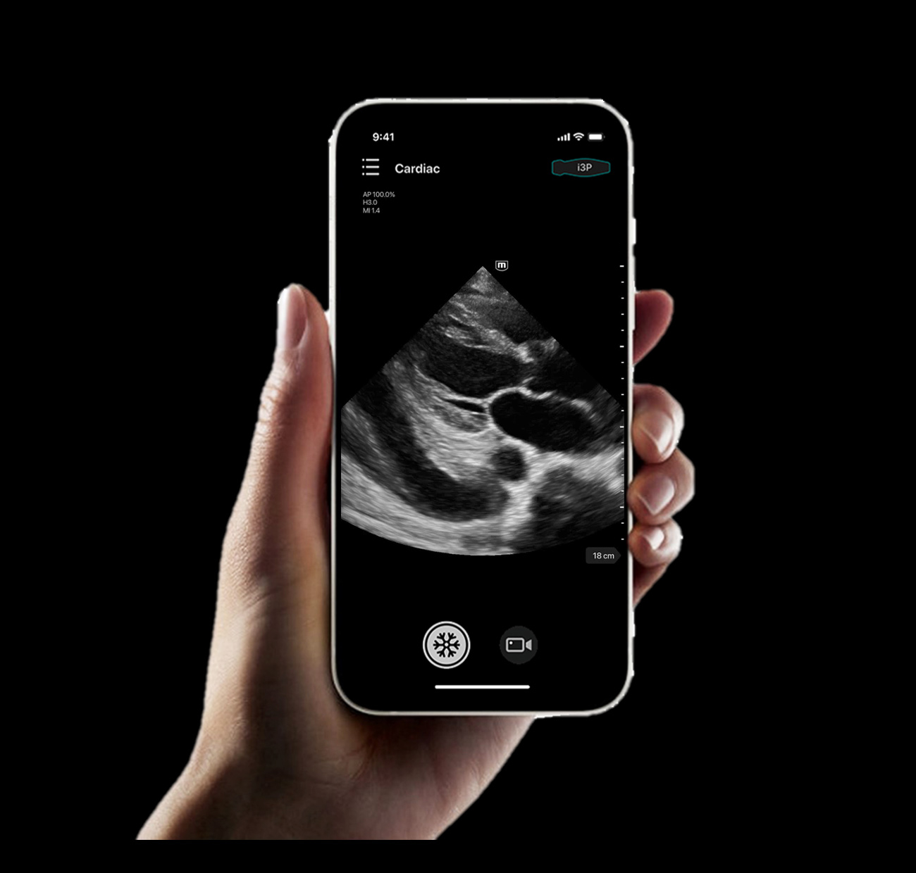 Ultrasonido ecógrafo portátil TE AIR MINDRAY - Imagen 7