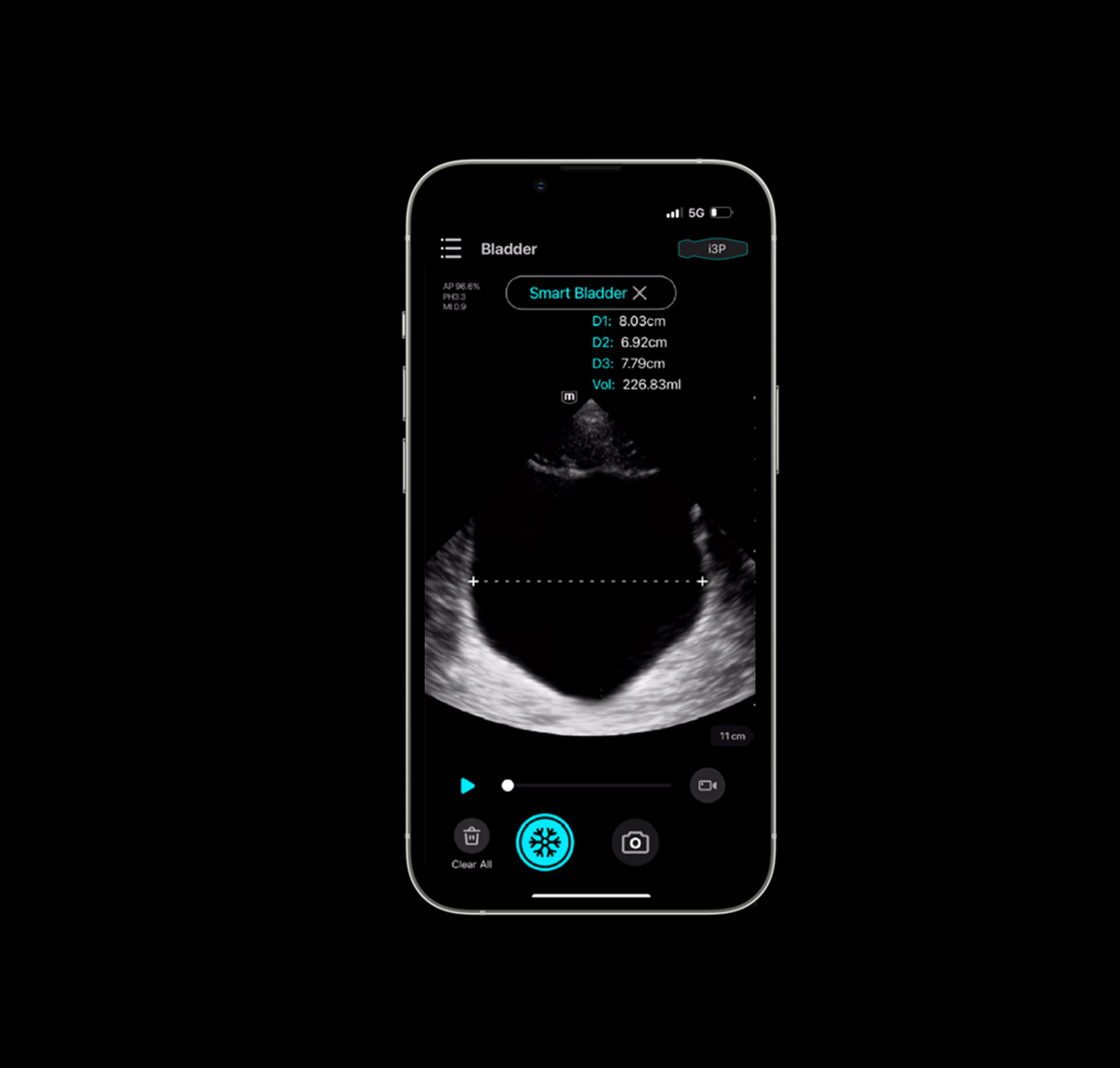 Ultrasonido ecógrafo portátil TE AIR MINDRAY - Imagen 6