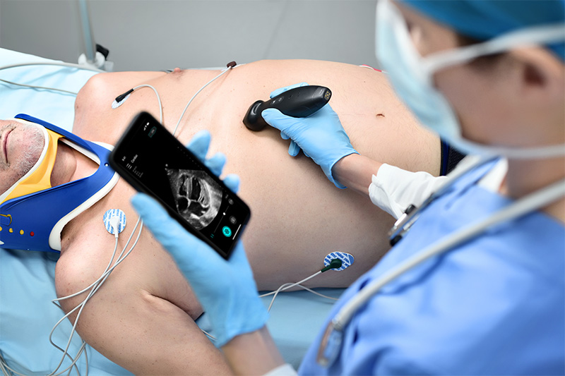 Ultrasonido ecógrafo portátil TE AIR MINDRAY - Imagen 4