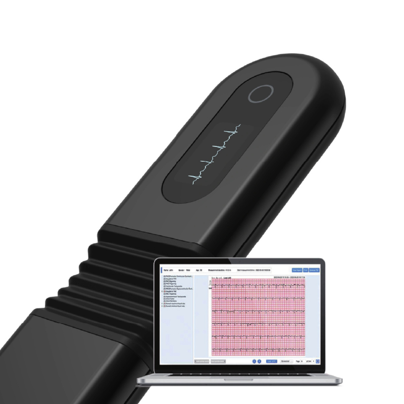 Monitor Holter ECG portátil de derivación única - Imagen 5